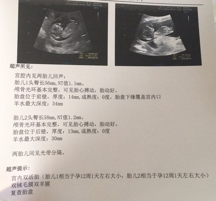 有双胎的宝妈吗？