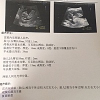 有双胎的宝妈吗？