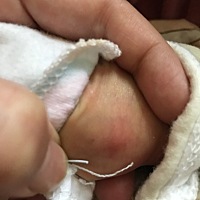 昨天是个小疙瘩   今天红肿了  大家知道吗？？？？？？急啊！！！！！