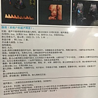 能看出是男宝女宝吗？