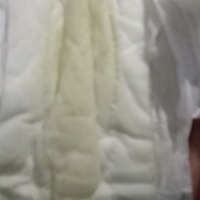 这是分泌物还是羊水