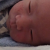 求解！着急，刚回来几天开着暖气还包着被子，孩子脸上出了一脸的红疹子，体检医生说包的太厚了！怎么办...