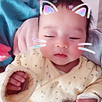 宝宝有红疹。干。红血丝的宝妈 看过来。给你推荐一款超级好用的。我女皮肤干干净净的！