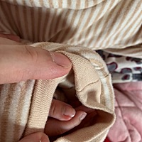 今天才发现宝宝大拇指肿起来了，不知道要不要紧？