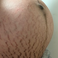 医生都说让我多爬楼梯5层的楼梯每天爬个二三十遍、目前还没有动静、我的肚子花成这样了😢