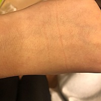 怀孕三个月被狗抓了一道，只红，也不疼，狗狗也打了疫苗，有同经历的宝妈嘛？用不用打狂犬疫苗，如果打...