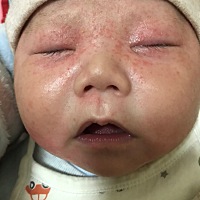 宝宝两个月大了，喝奶粉，脸上长了很多红点点是怎么回事啊