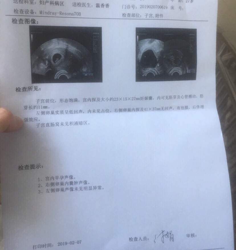 6周 5检查右侧有囊肿，之前有做过b超都没事，医生说是因为怀孕才有的，还是很担心，该怎么办？