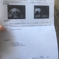 6周 5检查右侧有囊肿，之前有做过b超都没事，医生说是因为怀孕才有的，还是很担心，该怎么办？