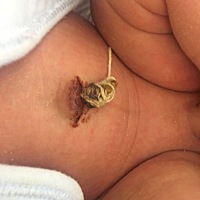 有没有亲知道这是怎么回事🥺