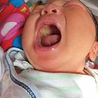 大家知道这是怎么了吗？口腔上鄂两侧发黄