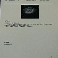 各位宝妈们好，我是一位三胎宝妈，大宝二宝都是男孩👦，希望自己有个小棉袄，听说看孕囊大小能看出男...