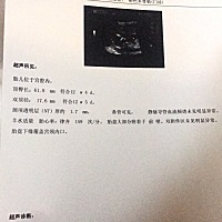 胎盘下缘覆盖宫颈内口，前三个月断断续续的在流血，一直都有卧床，好不容易到第十周不流血了，以为过了...