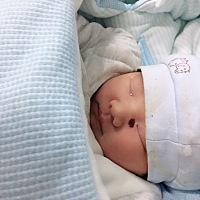 求助。宝宝出生那一刻看到脸上的胎记简直就是晴天霹雳，每天看着就想哭，有谁知道这是什么类型的胎记？...