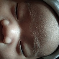 宝宝头上这个要怎么办啊？真的好丑