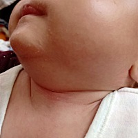 这两天温度27度热的小孩身上长这些什么办？