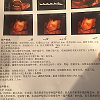 这能看出来男孩还是女孩吗？