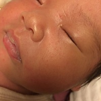 这种小红点是不是湿疹 是不是太热导致的？