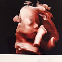 这么小的胎儿，就会嘬手指了😆😆😆