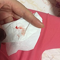 乳头开裂出血了，不知道是不是宝宝吸的，现在只能停两天母乳，吸的太痛了，眼泪都要出来了，大家有没有...