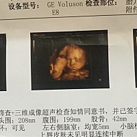 怀孕27周了    宝宝很可爱😘