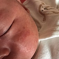 宝宝脸上长了湿疹，用了好几种湿疹膏也没效果，请问有什么好的办法？？？