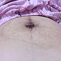 这肚子 不知道什么时候能恢复