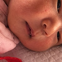 大家帮我看看 13天宝宝脸上长痘痘 还有额头长满了 这个是痱子还是什么