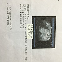 从第一次孕吐到第一条妊娠纹爬上我的肚子再到你的到来一切都是值得的 宝妈们大家一起相互交流备孕 孕期 ...