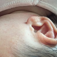 唉，这是什么啊，穿的也少，天天都洗澡，擦了婴宝，感觉没啥用啊。看着就心焦。