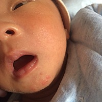 我家宝贝这个是不是时针呀，是不是热的？能搽药吗？