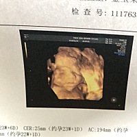 刚做的四维。大家看看是男孩还是女孩啊。实在好奇啊