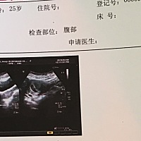 有没有看孕囊就知道男孩女孩的呀？准了给你们发红包🌹