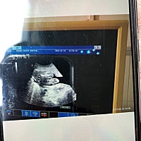 有会看的吗？这个图