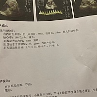 22+3，以为今天可以做四维了，结果医生说做四维前还要再做一次普通彩超，孕妈们是不是也这样的呢？
