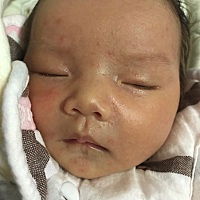 各位宝妈，这些是湿疹吗？用什么药好，还是不用管它自己会好