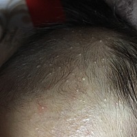 有宝妈知道这是什么吗？怎么才能好