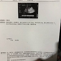 有没有会分辨男女的，帮我看看，感谢！