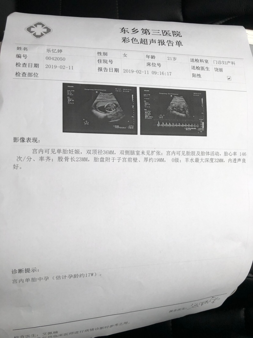 我这个好奇心总算是放下了 哈哈哈哈哈