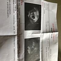 怀孕7周+，能不能看出男女😂