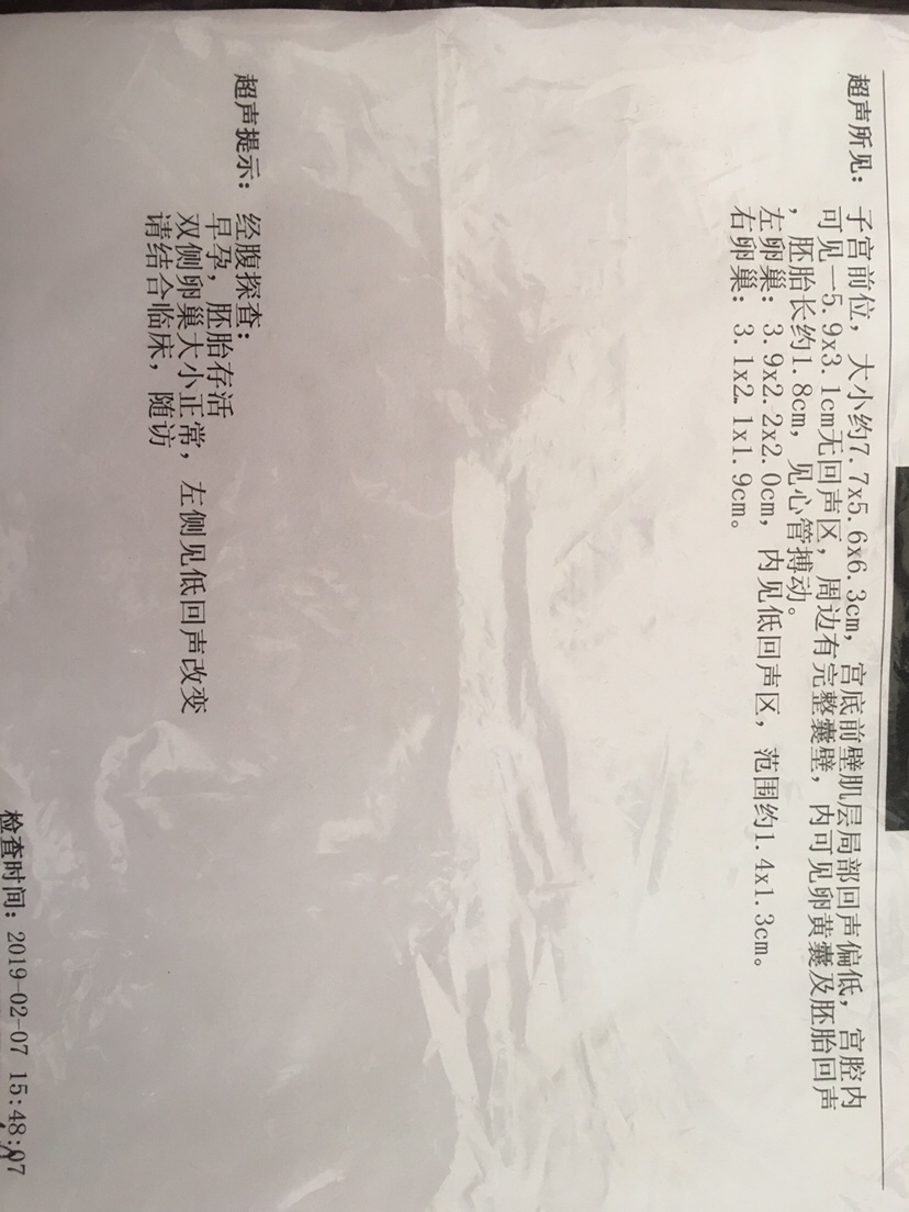 这是一个宝宝还是俩个？怎么左卵巢也有回声