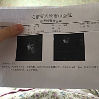 意外的二胎总是让人措不及防～ 希望是个小公主👸 约7周左右