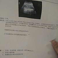孕妈们，谁懂孕嚷看男孩，女孩👧