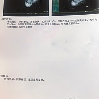 下午刚做的检查 热乎乎的胎心胎芽 怀孕54天 此刻的心情 激动 开心🥳小乖乖 一定要健康成长 妈妈爱...