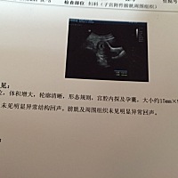 超级郁闷中…流血了，去医院检查了看了看，说是先兆性流产，打了黄体酮，拿了保胎药，唉，不知道小家伙...