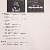 2019.2.11上午NT顺利通过！点赞接好孕！ 目前W12+5，接下来的各项检查还要和宝宝一起配合努力💪�...