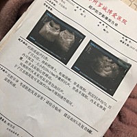 懂的帮我看看，我的孩子还有救吗