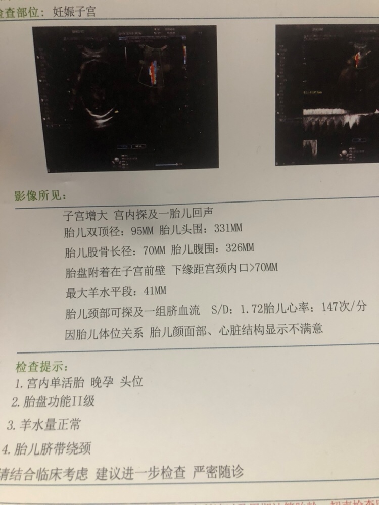 怀孕38周：胎儿双顶径95mm胎儿头围331mm
股骨长径：70mm，胎儿腹围：326mm
正常吗？做b超的医生说孩子头大，好担心，会不会有毛病？谁能看懂这个数据？还有谁能看出孩子多少斤，求解答