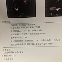 求助：怀孕38周：胎儿双顶径95mm头围331mm正常吗？ 怀孕38周：胎儿双顶径95mm胎儿头围331mm 股骨长径：7...