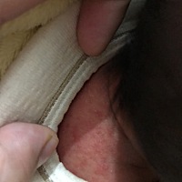 宝妈们，我家宝宝刚出才10天，男生，后背就有这样的东西，正常吗，宝宝睡觉的时候会痒，老摇头，